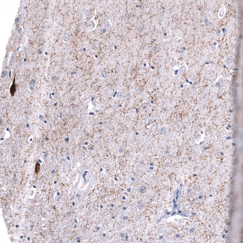 Somatostatin Antibody (CL15075) - Azide and BSA Free Immunohistochemistry-Paraffin: Somatostatin Antibody [NBP3-43930]