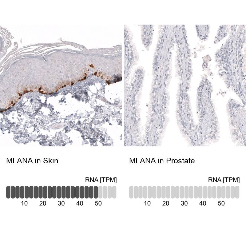 Melan-A/MART-1 Antibody (CL12864) - Azide and BSA Free Immunohistochemistry-Paraffin: Melan-A/MART-1 Antibody [NBP3-43932]