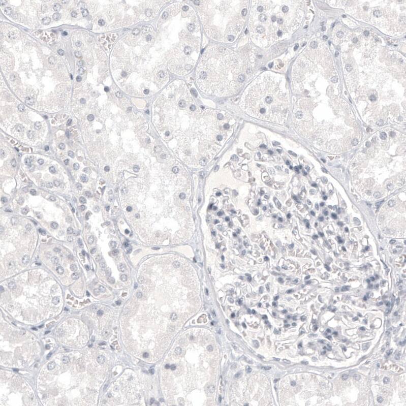 Melan-A/MART-1 Antibody (CL12864) - Azide and BSA Free Immunohistochemistry-Paraffin: Melan-A/MART-1 Antibody [NBP3-43932]