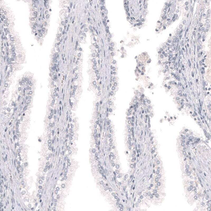 Melan-A/MART-1 Antibody (CL12864) - Azide and BSA Free Immunohistochemistry-Paraffin: Melan-A/MART-1 Antibody [NBP3-43932]
