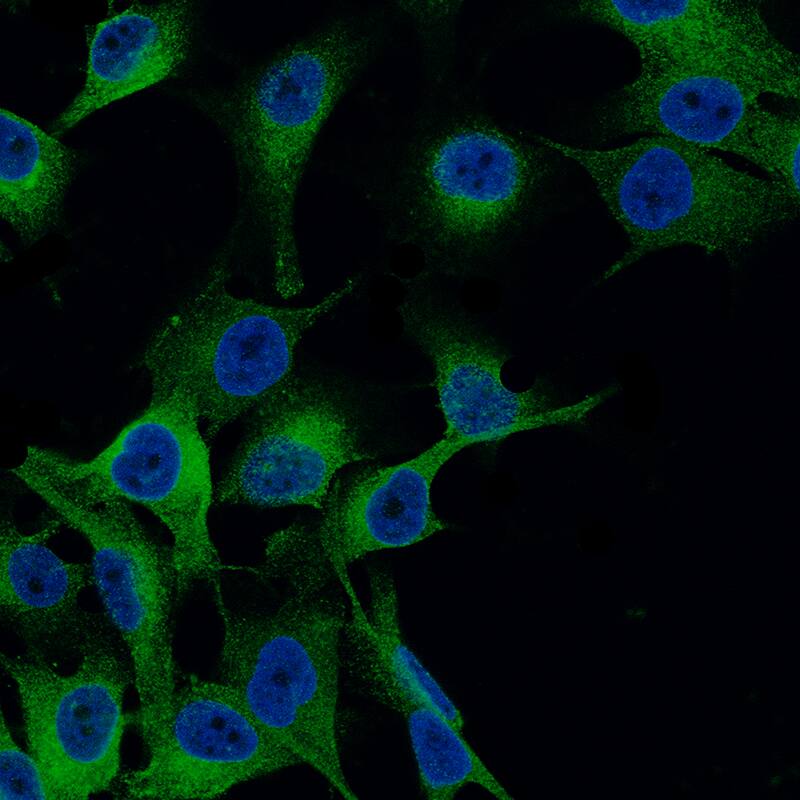 Melan-A/MART-1 Antibody (CL12864) - Azide and BSA Free Immunocytochemistry/ Immunofluorescence: Melan-A/MART-1 Antibody [NBP3-43932]