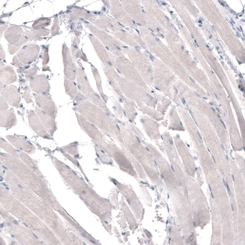 HMG-CoA Reductase/HMGCR Antibody (CL0260) - Azide and BSA Free Immunohistochemistry-Paraffin: HMG-CoA Reductase/HMGCR Antibody [NBP3-43933]