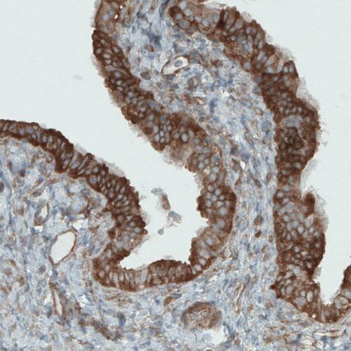 DIAPH-2 Antibody (CL1111) - Azide and BSA Free Immunohistochemistry-Paraffin: DIAPH-2 Antibody [NBP3-43934]