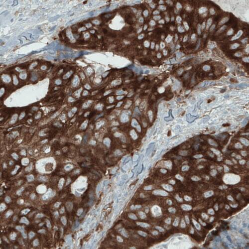 DIAPH-2 Antibody (CL1111) - Azide and BSA Free Immunohistochemistry-Paraffin: DIAPH-2 Antibody [NBP3-43934]