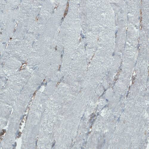 DIAPH-2 Antibody (CL1111) - Azide and BSA Free Immunohistochemistry-Paraffin: DIAPH-2 Antibody [NBP3-43934]