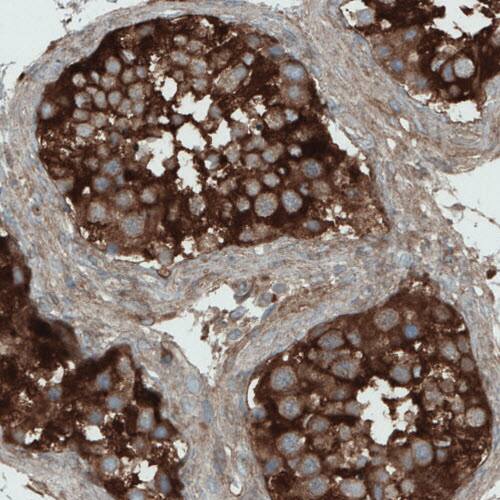 DIAPH-2 Antibody (CL1111) - Azide and BSA Free Immunohistochemistry-Paraffin: DIAPH-2 Antibody [NBP3-43934]