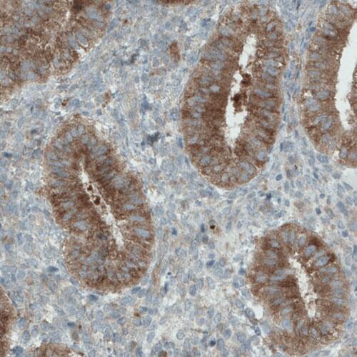 DIAPH-2 Antibody (CL1111) - Azide and BSA Free Immunohistochemistry-Paraffin: DIAPH-2 Antibody [NBP3-43934]