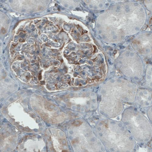 DIAPH-2 Antibody (CL1113) - Azide and BSA Free Immunohistochemistry-Paraffin: DIAPH-2 Antibody [NBP3-43935]