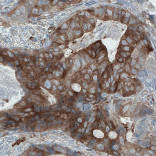DIAPH-2 Antibody (CL1113) - Azide and BSA Free Immunohistochemistry-Paraffin: DIAPH-2 Antibody [NBP3-43935]