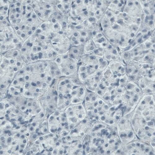 DIAPH-2 Antibody (CL1113) - Azide and BSA Free Immunohistochemistry-Paraffin: DIAPH-2 Antibody [NBP3-43935]