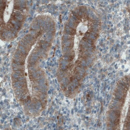 DIAPH-2 Antibody (CL1113) - Azide and BSA Free Immunohistochemistry-Paraffin: DIAPH-2 Antibody [NBP3-43935]