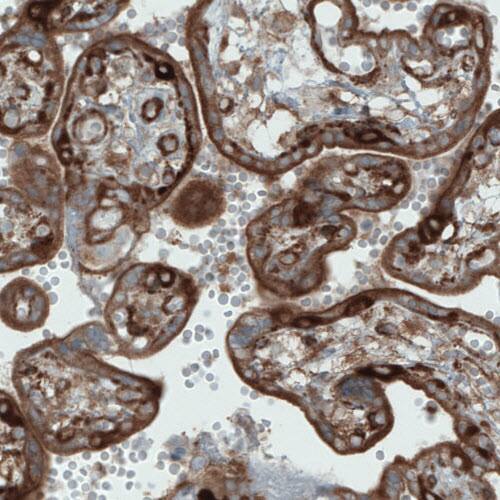 DIAPH-2 Antibody (CL1113) - Azide and BSA Free Immunohistochemistry-Paraffin: DIAPH-2 Antibody [NBP3-43935]
