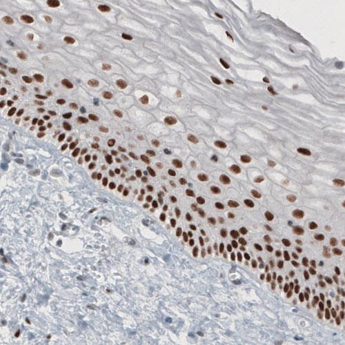 TLE3 Antibody (CL3573) - Azide and BSA Free Immunohistochemistry-Paraffin: TLE3 Antibody [NBP3-43936]