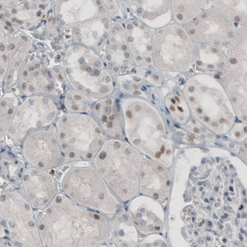 TLE3 Antibody (CL3573) - Azide and BSA Free Immunohistochemistry-Paraffin: TLE3 Antibody [NBP3-43936]