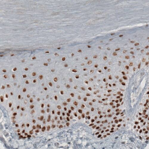 TLE3 Antibody (CL3573) - Azide and BSA Free Immunohistochemistry-Paraffin: TLE3 Antibody [NBP3-43936]