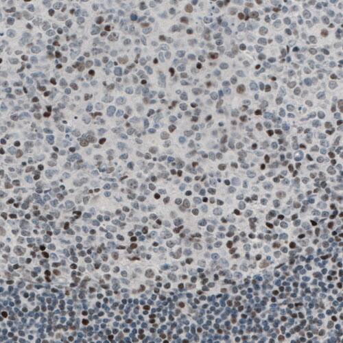 TLE3 Antibody (CL3573) - Azide and BSA Free Immunohistochemistry-Paraffin: TLE3 Antibody [NBP3-43936]