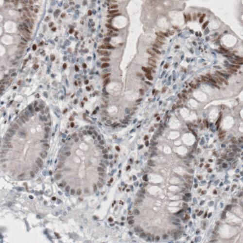 TLE3 Antibody (CL3573) - Azide and BSA Free Immunohistochemistry-Paraffin: TLE3 Antibody [NBP3-43936]