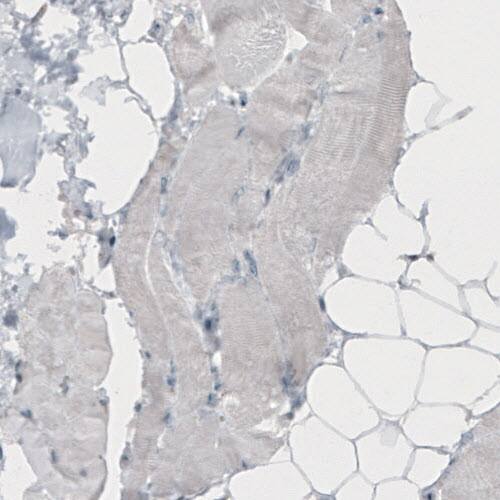 TLE3 Antibody (CL3573) - Azide and BSA Free Immunohistochemistry-Paraffin: TLE3 Antibody [NBP3-43936]