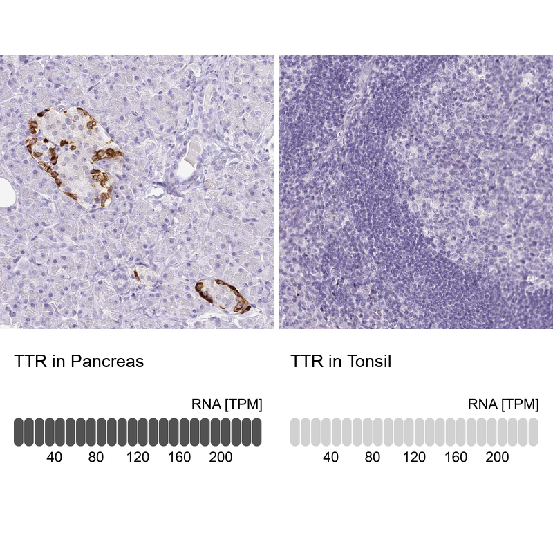 Transthyretin/Prealbumin Antibody (CL0290) - Azide and BSA Free Immunohistochemistry-Paraffin: Transthyretin/Prealbumin Antibody [NBP3-43937]