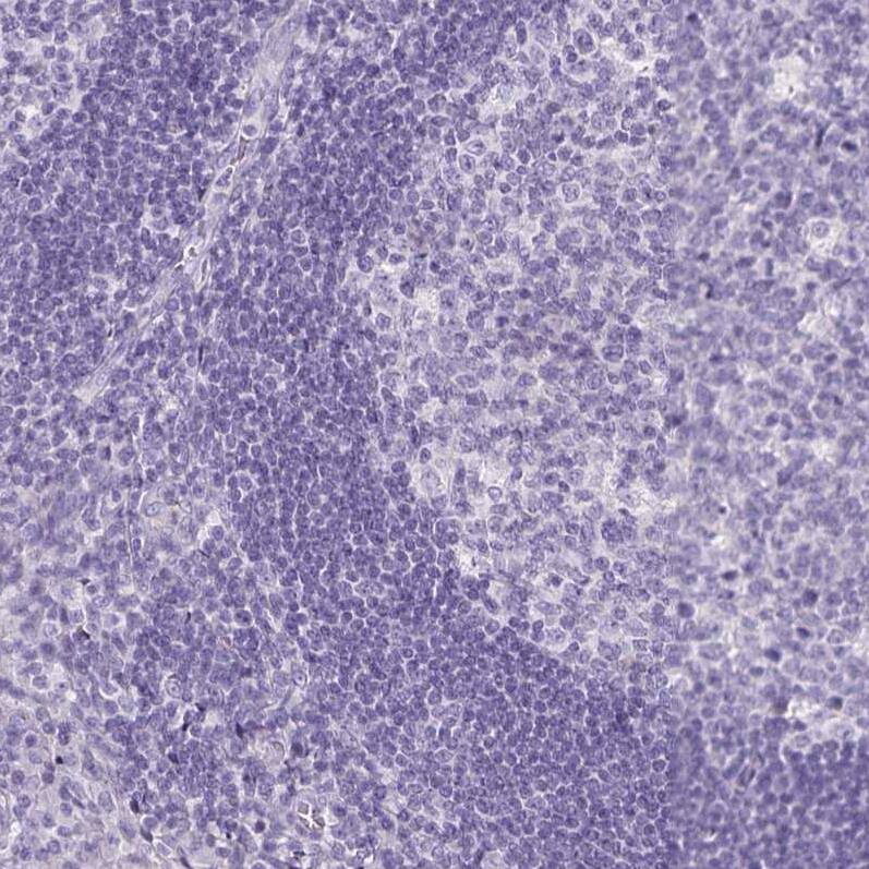 Transthyretin/Prealbumin Antibody (CL0290) - Azide and BSA Free Immunohistochemistry-Paraffin: Transthyretin/Prealbumin Antibody [NBP3-43937]