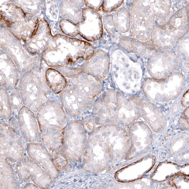TRPM4 Antibody (CL11214) - Azide and BSA Free Immunohistochemistry-Paraffin: TRPM4 Antibody [NBP3-43938]