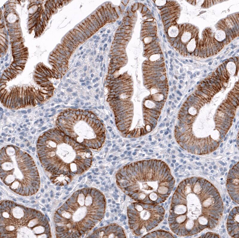 TRPM4 Antibody (CL11214) - Azide and BSA Free Immunohistochemistry-Paraffin: TRPM4 Antibody [NBP3-43938]