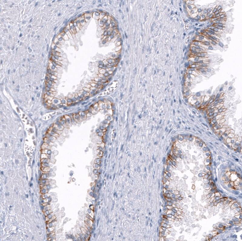 TRPM4 Antibody (CL11214) - Azide and BSA Free Immunohistochemistry-Paraffin: TRPM4 Antibody [NBP3-43938]