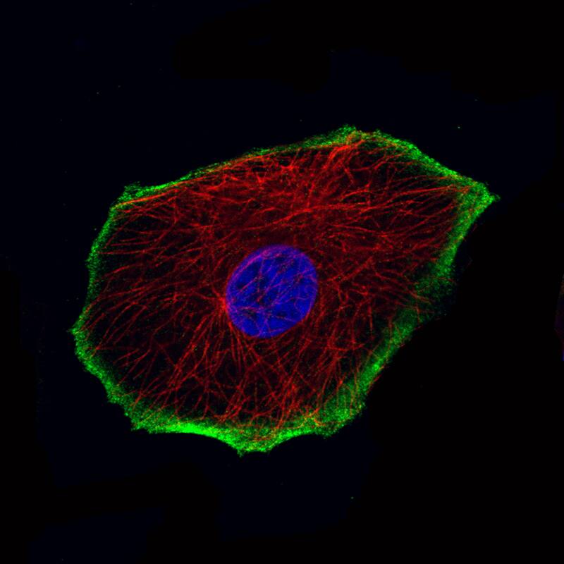 TRPM4 Antibody (CL11214) - Azide and BSA Free Immunocytochemistry/ Immunofluorescence: TRPM4 Antibody [NBP3-43938]
