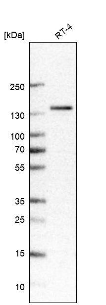 TRPM4 Antibody (CL11214) - Azide and BSA Free Western Blot: TRPM4 Antibody [NBP3-43938]
