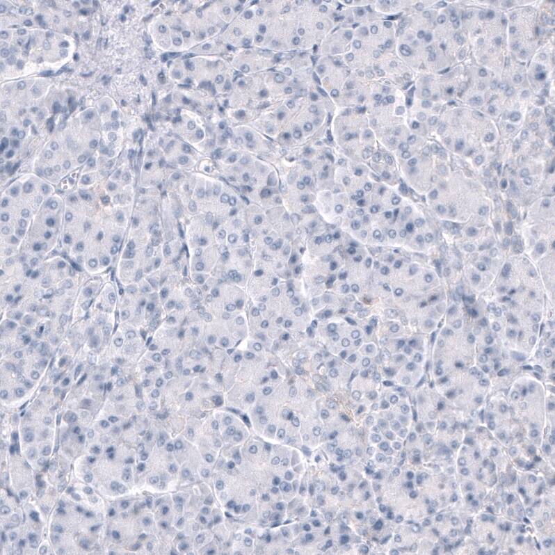 TRPM4 Antibody (CL11214) - Azide and BSA Free Immunohistochemistry-Paraffin: TRPM4 Antibody [NBP3-43938]