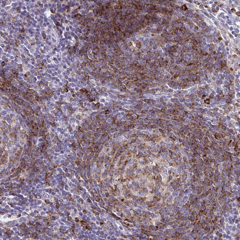 Syntaxin 7 Antibody (CL0257) - Azide and BSA Free Immunohistochemistry-Paraffin: Syntaxin 7 Antibody [NBP3-43939]