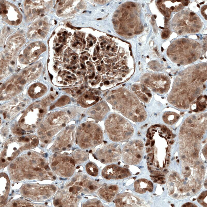STAT3 Antibody (CL0490) - Azide and BSA Free Immunohistochemistry-Paraffin: STAT3 Antibody [NBP3-43940]