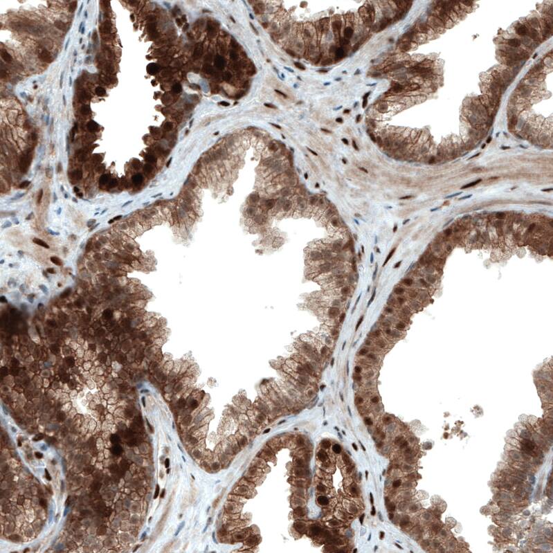 STAT3 Antibody (CL0490) - Azide and BSA Free Immunohistochemistry-Paraffin: STAT3 Antibody [NBP3-43940]