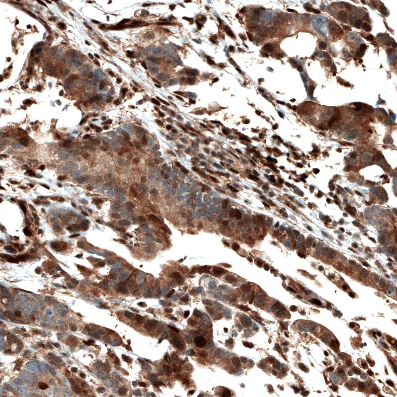 STAT3 Antibody (CL0490) - Azide and BSA Free Immunohistochemistry-Paraffin: STAT3 Antibody [NBP3-43940]