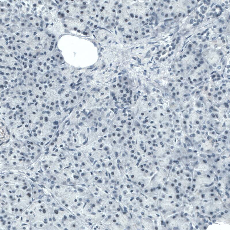 STAT3 Antibody (CL0490) - Azide and BSA Free Immunohistochemistry-Paraffin: STAT3 Antibody [NBP3-43940]