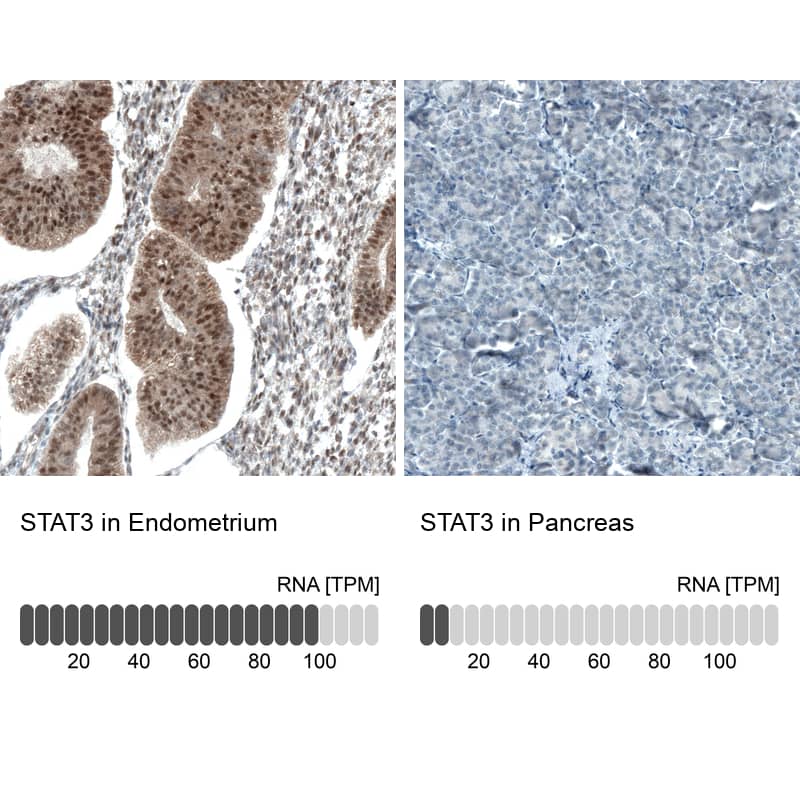 STAT3 Antibody (CL0492) - Azide and BSA Free Immunohistochemistry-Paraffin: STAT3 Antibody [NBP3-43941]
