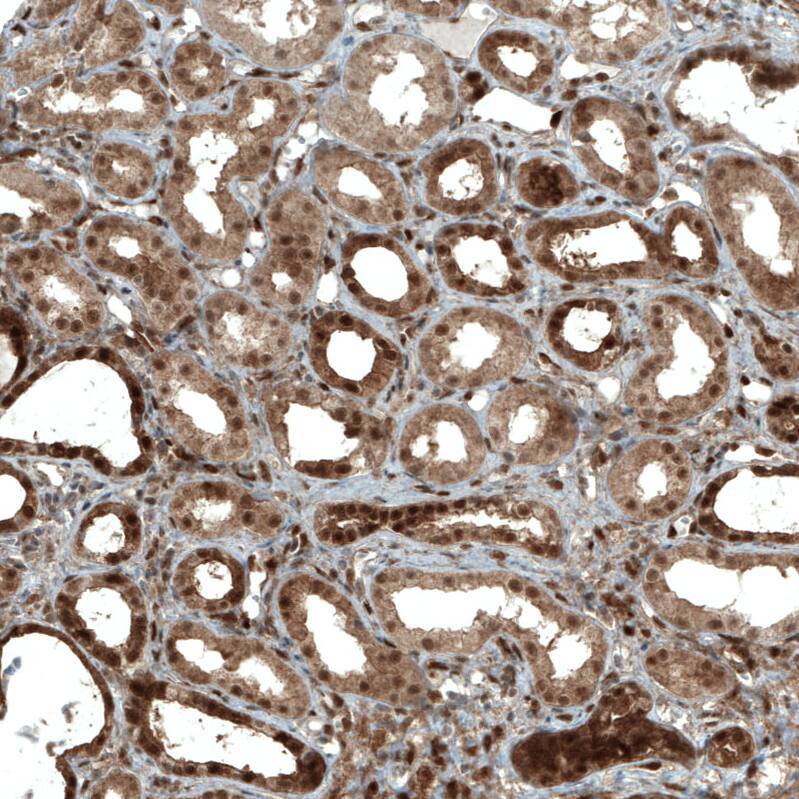 STAT3 Antibody (CL0492) - Azide and BSA Free Immunohistochemistry-Paraffin: STAT3 Antibody [NBP3-43941]