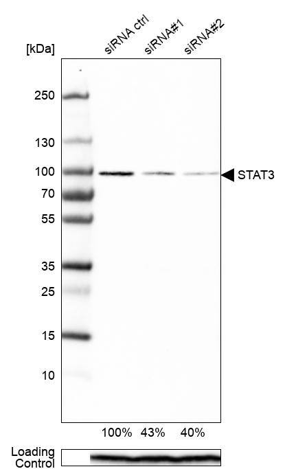 STAT3 Antibody (CL0492) - Azide and BSA Free Western Blot: STAT3 Antibody [NBP3-43941]