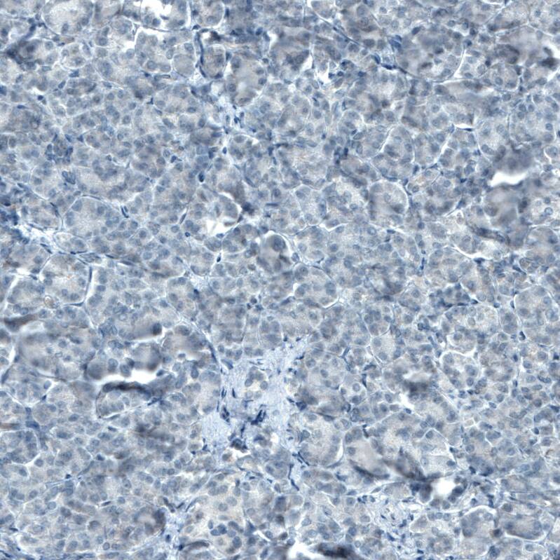 STAT3 Antibody (CL0492) - Azide and BSA Free Immunohistochemistry-Paraffin: STAT3 Antibody [NBP3-43941]