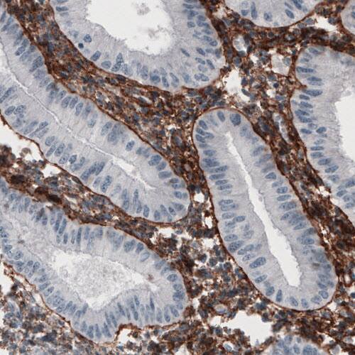 Fibronectin Antibody (CL3730) - Azide and BSA Free Immunohistochemistry-Paraffin: Fibronectin Antibody [NBP3-43942]
