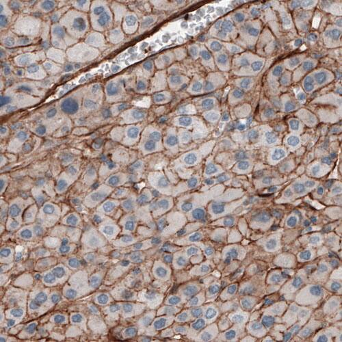 Fibronectin Antibody (CL3730) - Azide and BSA Free Immunohistochemistry-Paraffin: Fibronectin Antibody [NBP3-43942]