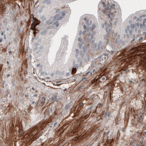 Fibronectin Antibody (CL3730) - Azide and BSA Free Immunohistochemistry-Paraffin: Fibronectin Antibody [NBP3-43942]