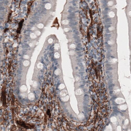 Fibronectin Antibody (CL3730) - Azide and BSA Free Immunohistochemistry-Paraffin: Fibronectin Antibody [NBP3-43942]