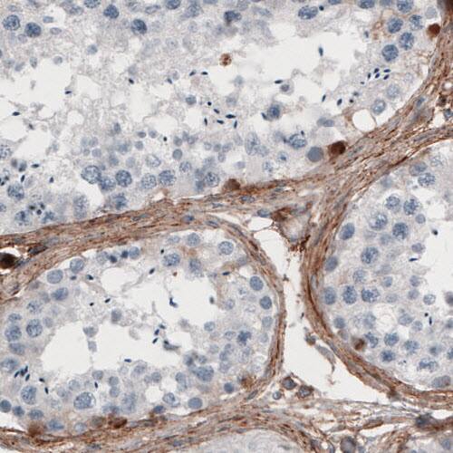 Fibronectin Antibody (CL3730) - Azide and BSA Free Immunohistochemistry-Paraffin: Fibronectin Antibody [NBP3-43942]