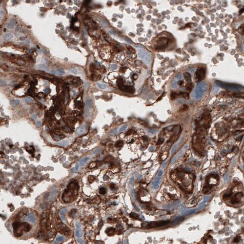 Fibronectin Antibody (CL3730) - Azide and BSA Free Immunohistochemistry-Paraffin: Fibronectin Antibody [NBP3-43942]