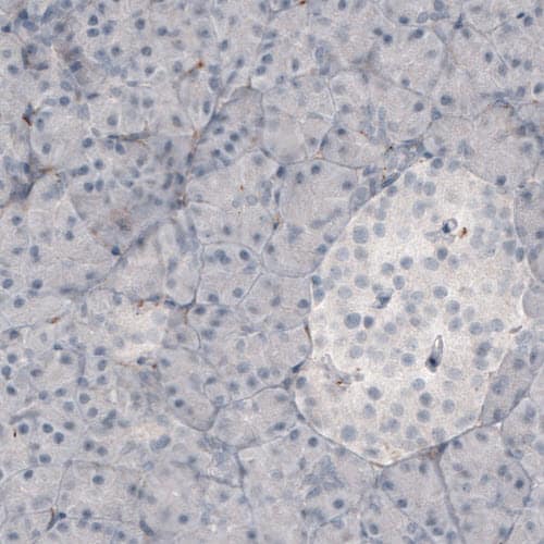 Fibronectin Antibody (CL3730) - Azide and BSA Free Immunohistochemistry-Paraffin: Fibronectin Antibody [NBP3-43942]