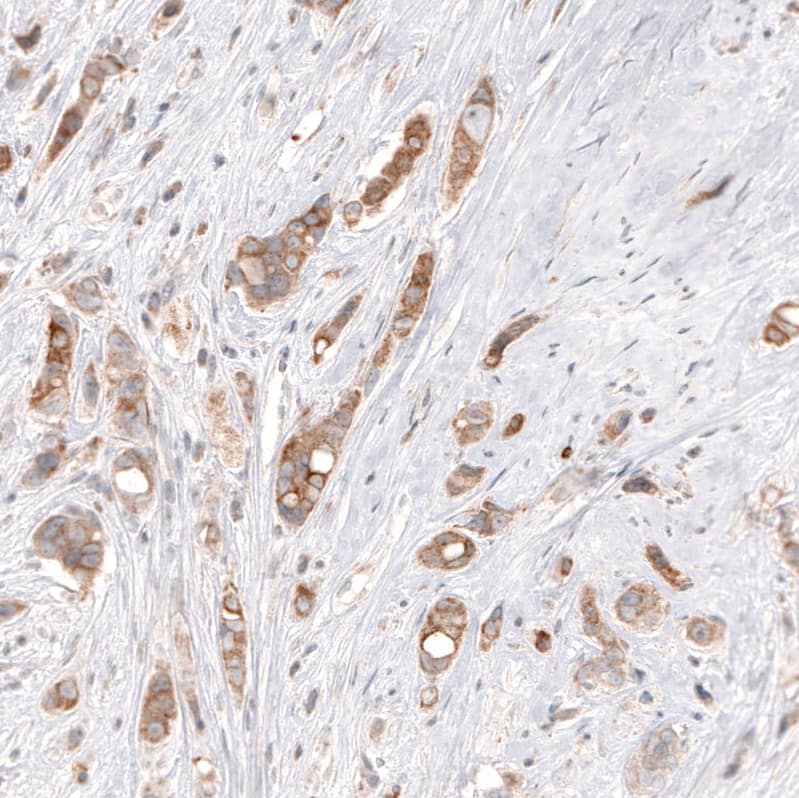 HMG-CoA Reductase/HMGCR Antibody (CL0259) - Azide and BSA Free Immunohistochemistry-Paraffin: HMG-CoA Reductase/HMGCR Antibody [NBP3-43943]