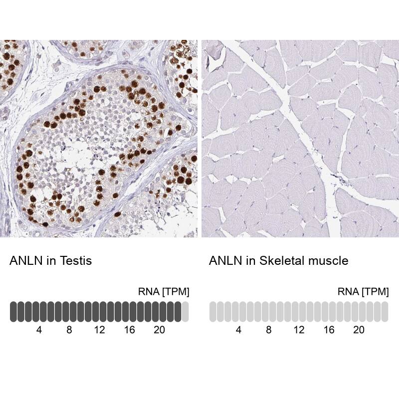 Anillin Antibody (CL0301) - Azide and BSA Free Immunohistochemistry-Paraffin: Anillin Antibody [NBP3-43944]