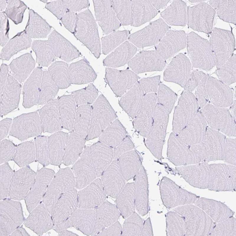 Anillin Antibody (CL0301) - Azide and BSA Free Immunohistochemistry-Paraffin: Anillin Antibody [NBP3-43944]