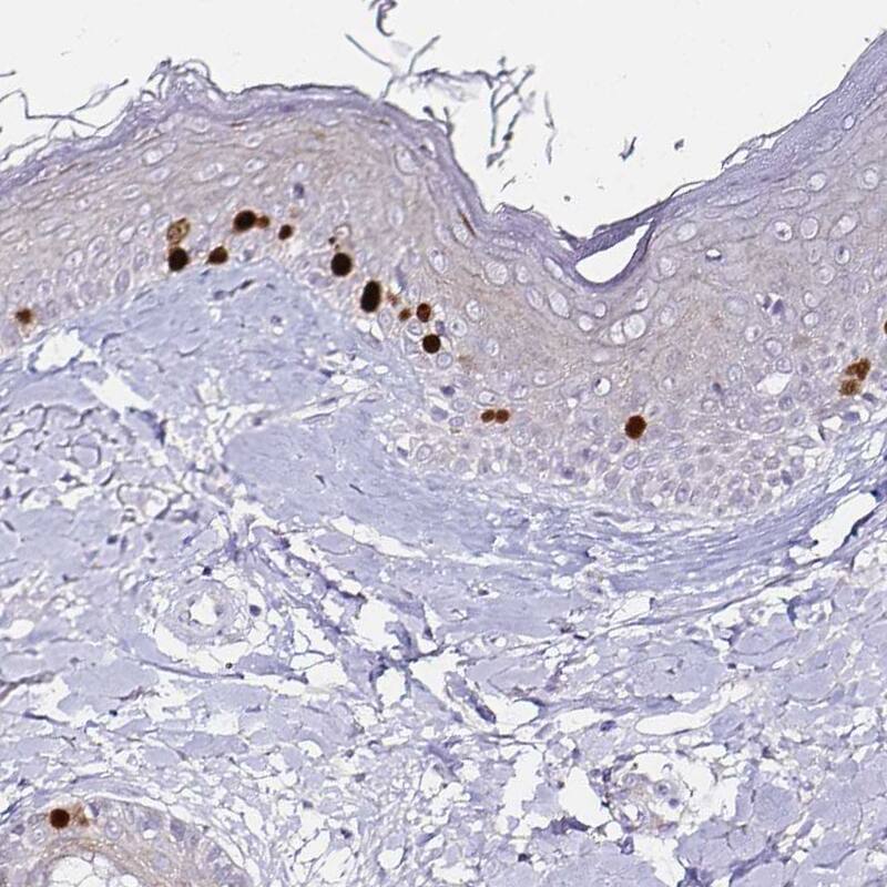 Anillin Antibody (CL0301) - Azide and BSA Free Immunohistochemistry-Paraffin: Anillin Antibody [NBP3-43944]